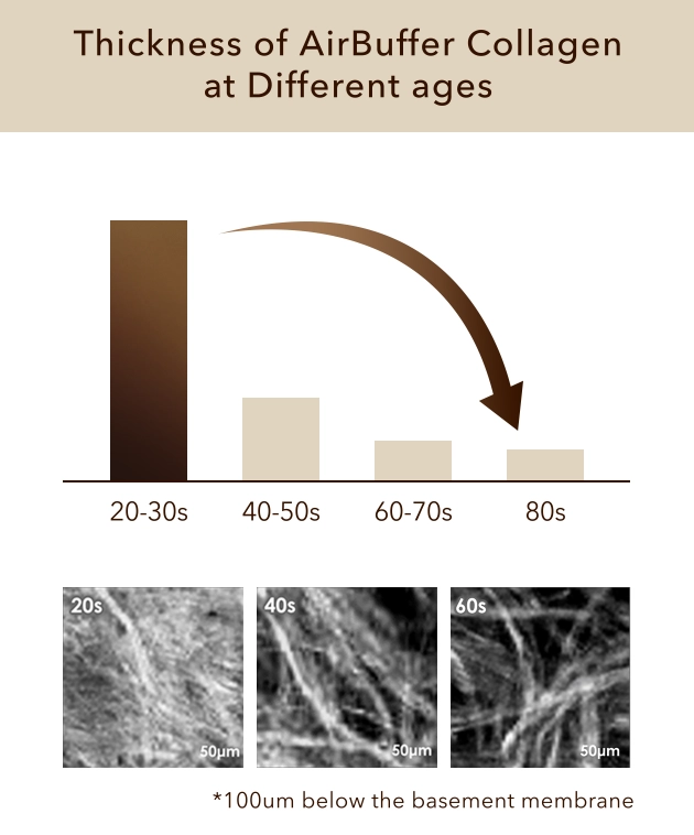 Thickness of AirBuffer Collagen at Different Ages
