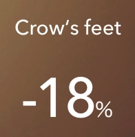 Crow’s feet -18%